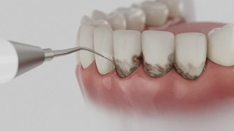 Reliable Dental contractor in Bluffton, IN by Dentist Open Now